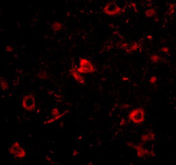 Nanos3 Antibody抗体，orb1239394，b