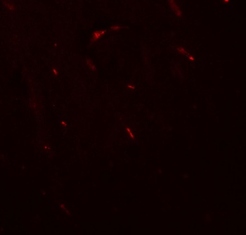 FOXG1 Antibody抗体，orb1239787，bi