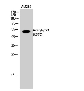 p53 (Acetyl Lys370) rabbit pAb