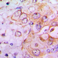 PFKFB2 Antibody抗体，orb256748，bi