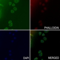 Collagen 15 alpha 1 Antibody抗体