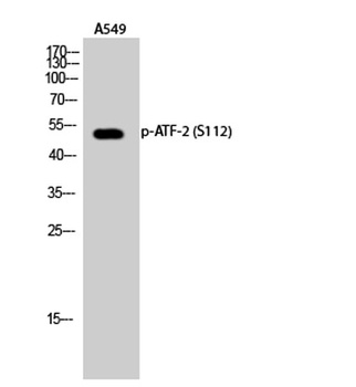 ATF-2 (phospho Ser112) rabbit