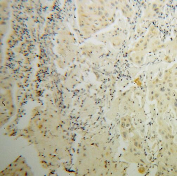 STAT5A Antibody抗体，orb631571，bi