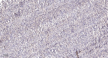 PRDM3 rabbit pAb抗体,orb769090,b