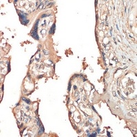 HGFL Antibody抗体,orb667338,bior