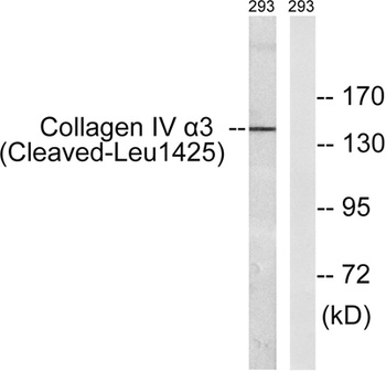 Cleaved-COL4A3 (L1425) rabbit