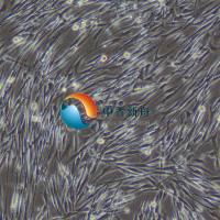 人脑血管平滑肌细胞永生化