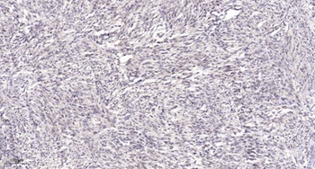 BUD31 rabbit pAb抗体，orb764677，b