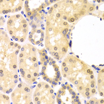 SMAD1 Antibody抗体,orb1261320,bi