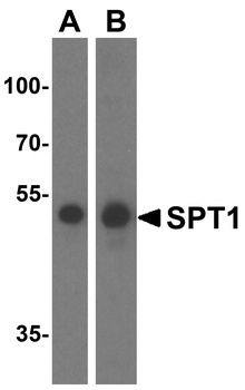 SPT1 Antibody抗体，orb1238894，bio