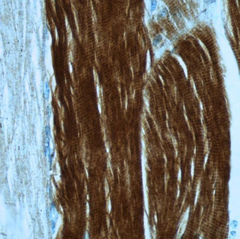 TNNI2 Antibody抗体，orb632029，bio