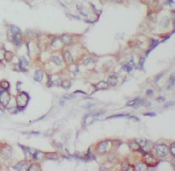 FYN Antibody抗体，orb756640，biorb