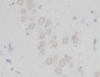 PCDH10 Antibody抗体，orb632860，bi