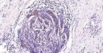 Tau-4 Mouse Monoclonal Antibod