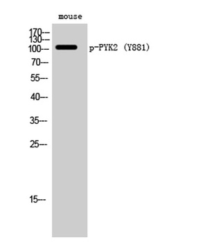 PYK2 (phospho Tyr881) rabbit p