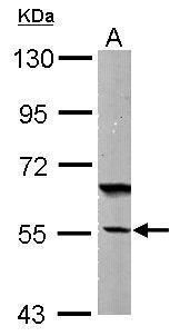 DNAJC7 antibody [N2C3]抗体，orb55