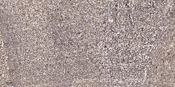 CBP20 rabbit pAb抗体,orb764757,b