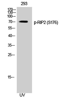 RIP2 (phospho Ser176) rabbit p