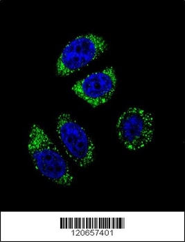 EDN1 Antibody抗体，orb1269869，bio