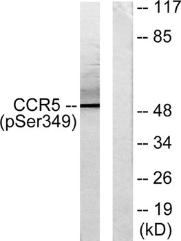 CKR-5 (phospho Ser349) rabbit 