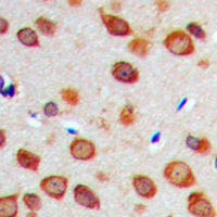 NOTCH1 Antibody抗体，orb256723，bi