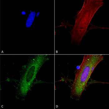 NR2A Antibody抗体,orb99103,biorb