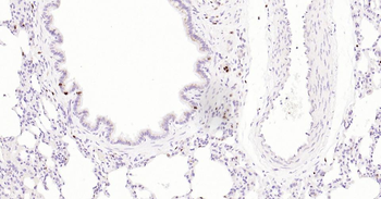 5 Lipoxygenase Recombinant Rab
