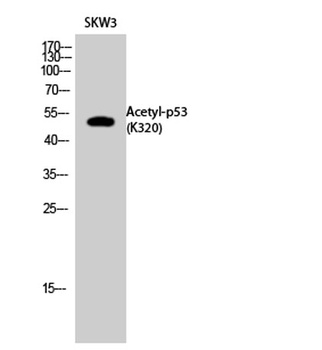 p53 (Acetyl Lys320) rabbit pAb