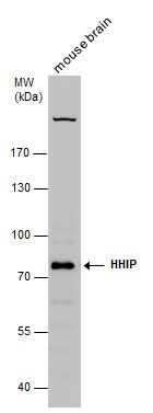 HHIP antibody [N3C2], Internal