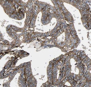 TSP50 Antibody抗体，orb632209，bio