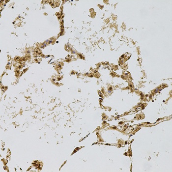 PLK4 Antibody抗体，orb1255543，bio