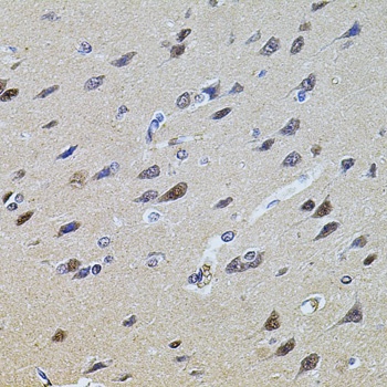 PLK4 Antibody抗体，orb1255543，bio