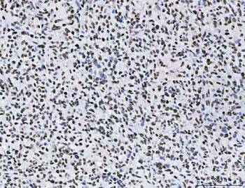 AREB6/ZEB1 Antibody (monoclona
