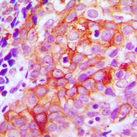 Beta-2 Adrenergic Receptor Ant