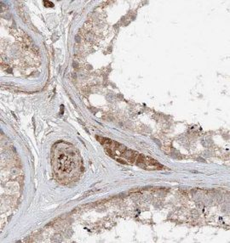 TMX3 Antibody抗体，orb632003，bior