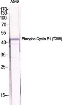 Cyclin E1 (phospho Thr395) rab