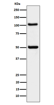 ORP1 Rabbit mAb [KD Validated]
