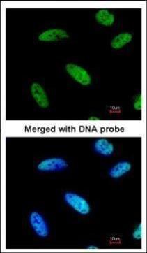 DNAJC7 antibody [N2C3]抗体，orb55
