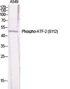 ATF-2 (phospho Ser112) rabbit