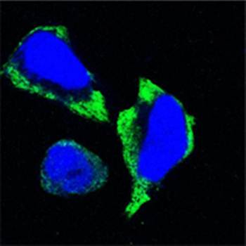 PAK2 Antibody抗体，orb97576，biorb