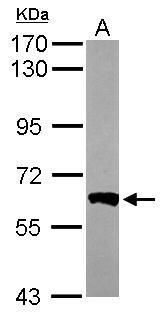 PPP3CB antibody [N1N3]抗体，orb55