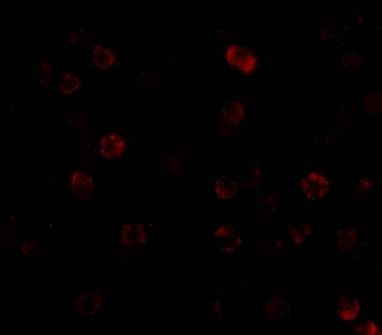 IKK alpha Antibody抗体，orb123968