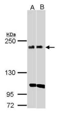 KIDINS220 antibody [C3], C-ter