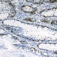 PPAR gamma Antibody抗体，orb31565