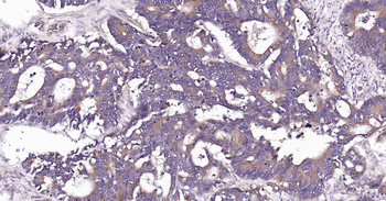 RalA Recombinant Rabbit Monocl