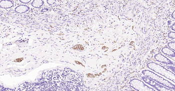 Tau-4 Mouse Monoclonal Antibod