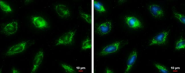 Fumarate hydratase antibody [N