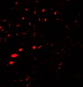 AQP2 Antibody抗体，orb1240211，bio