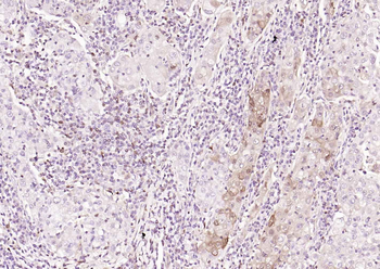 S100A4 Mouse Monoclonal Antibo