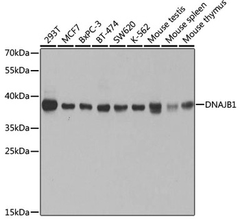 DNAJB1 Antibody, KO Validated抗